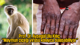 Prof. Dr. Ayşegül Ulu Kılıç: “Maymun çiçeği virüsü kolayca bulaşabiliyor”