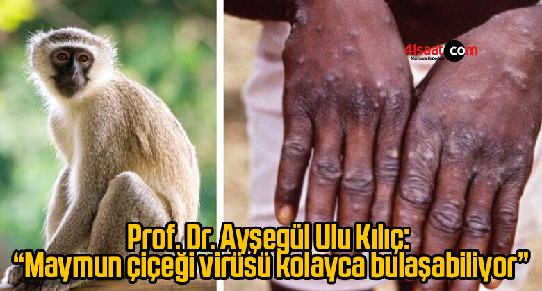 Prof. Dr. Ayşegül Ulu Kılıç: “Maymun çiçeği virüsü kolayca bulaşabiliyor”